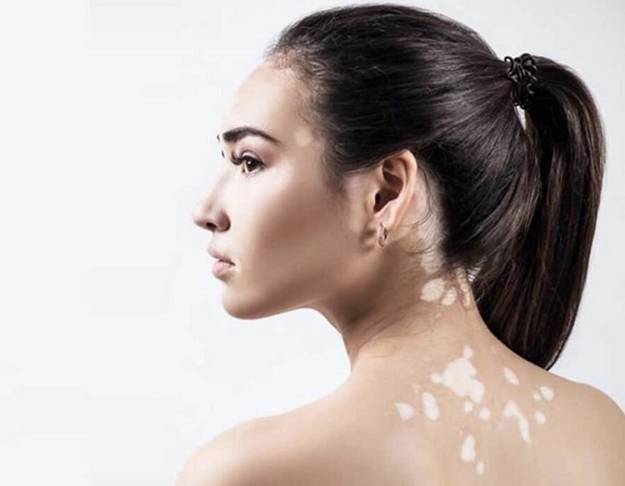 AVS PLASTIC SURGERY AND SKIN CLINIC Pudukkottai